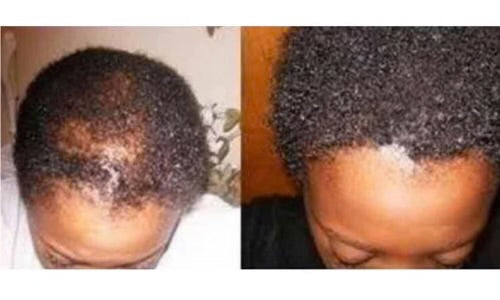 BOTANIC  BANANA OIL ®